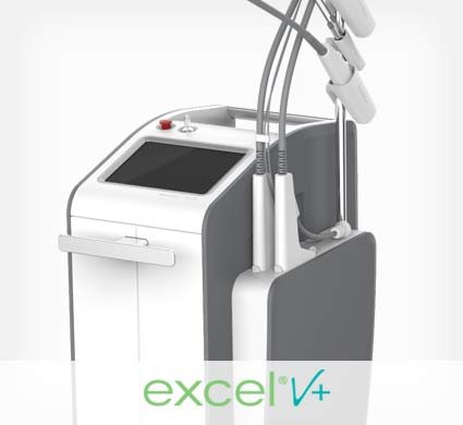 excel v+